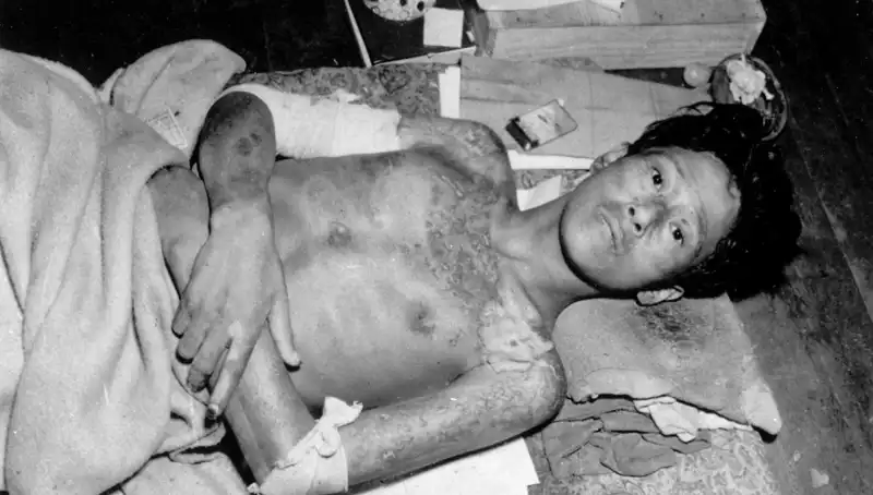 80 Yıl Sonra Nagasaki'den Gelen Uyarı: Nükleer Tehdit Yeniden Gündemde!