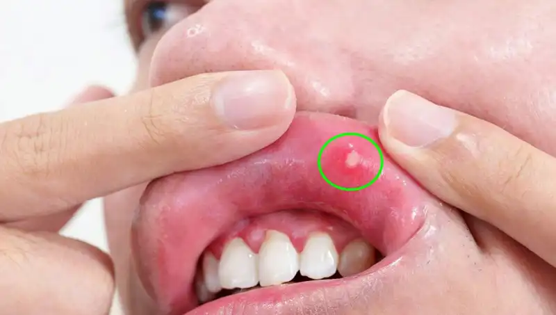 Kanserin Sessiz Uyarısı: Dilin Alınması Gereken Kasvetli Öykü