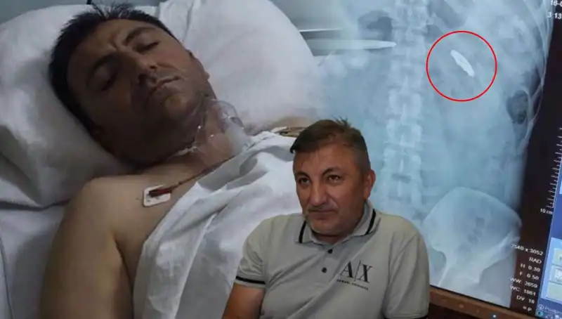 15 Temmuz’un Acı Mirası: Vücudundaki Kurşunla Yaşayan Adamın Hikayesi