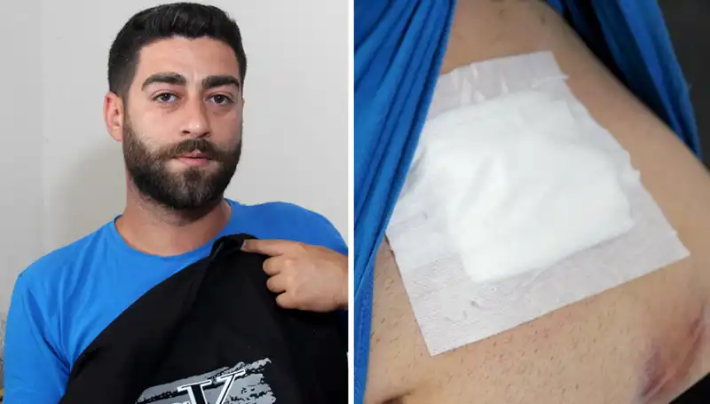 Karnındaki Ağrının Sebebi Röntgendeki Şaşırtıcı Sonuçla Ortaya Çıktı