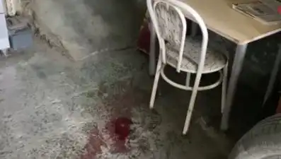Sandalyeden Düşen Adamın Yaşadığı Kaza, Şehirde Şok Etkisi Yarattı